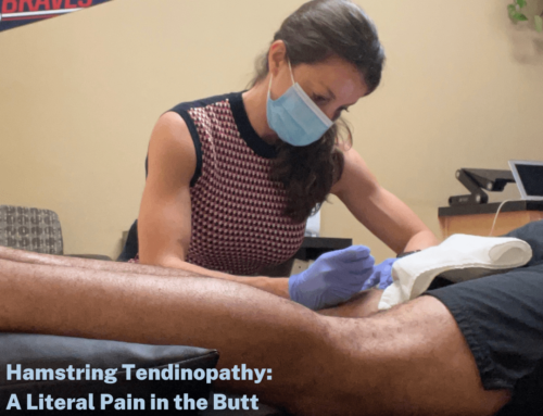 Hamstring Tendinopathy: A Literal Pain in the Butt