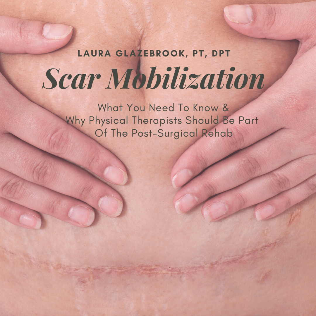 scar mobilization
